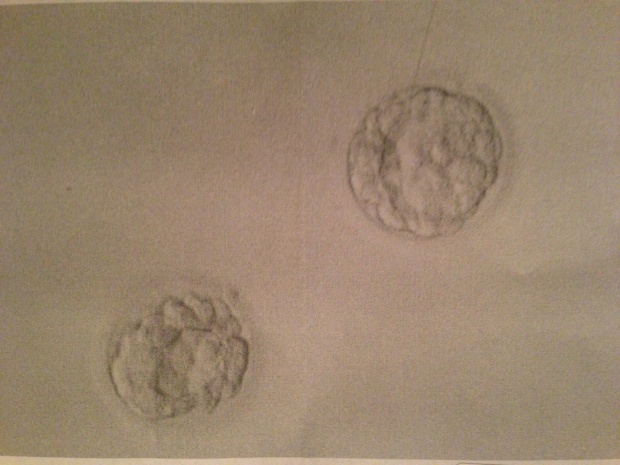 FET 3 Embryos